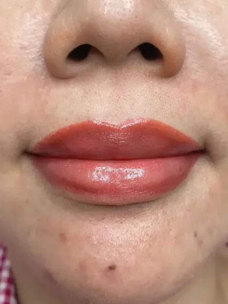 Lips.